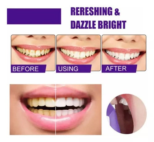 Sonrisa Blanca al Instante | SOLO HOY 60% OFF 🦷