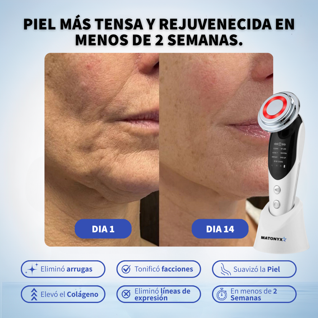 Masajeador Facial con frio y calor Antiarrugas + 3 Mascarillas de Colágeno GRATIS