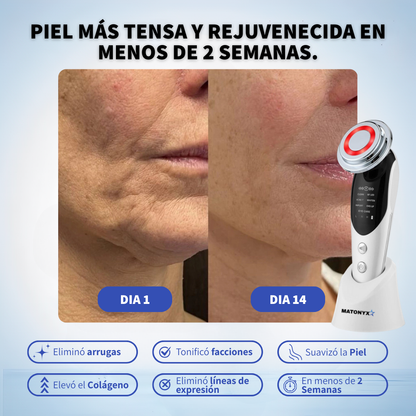 Masajeador Facial con frio y calor Antiarrugas + 3 Mascarillas de Colágeno GRATIS