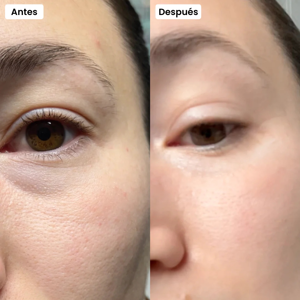 OpenEyes™ Ojos brillantes en ¡Menos de 15 minutos! - Entrega en 24h hábiles